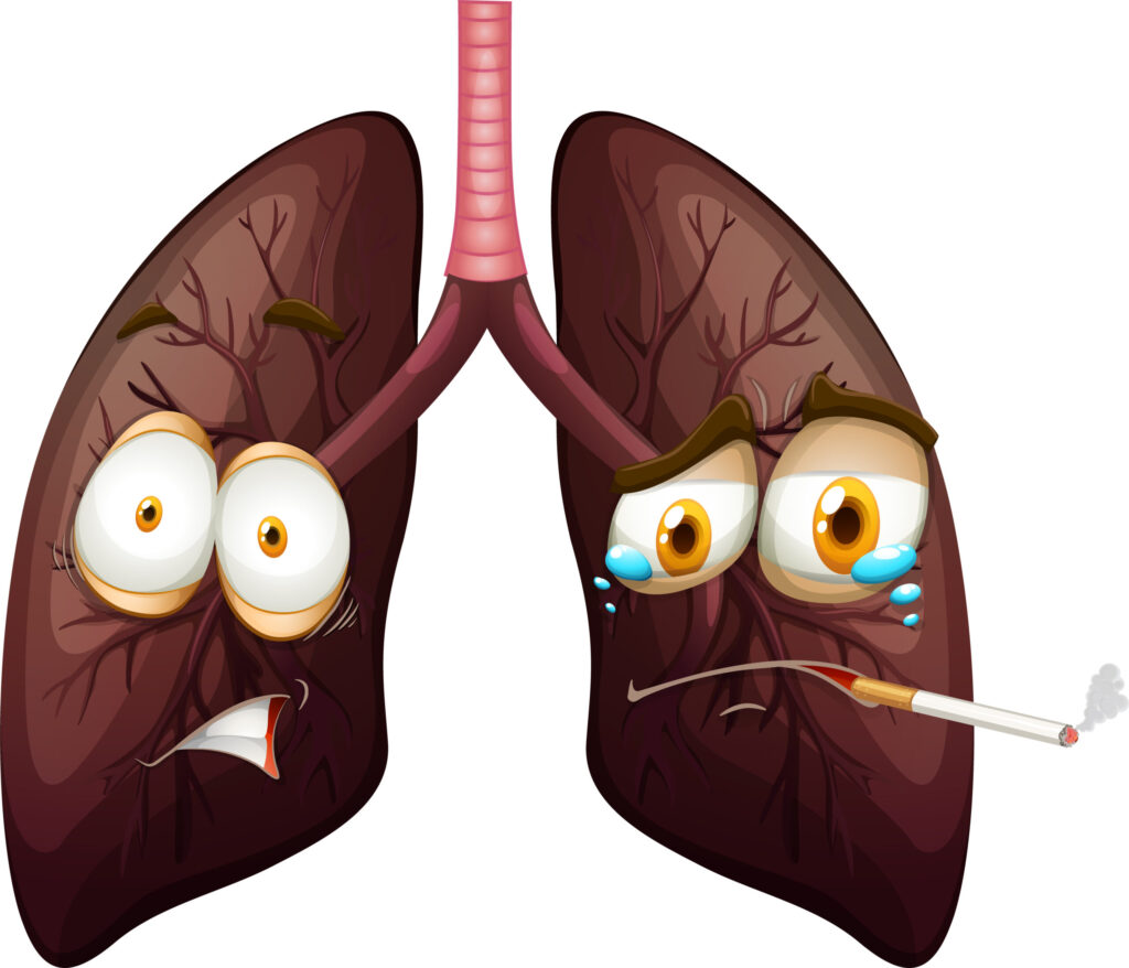 lung cancer doctor kompaly scaled.jpg