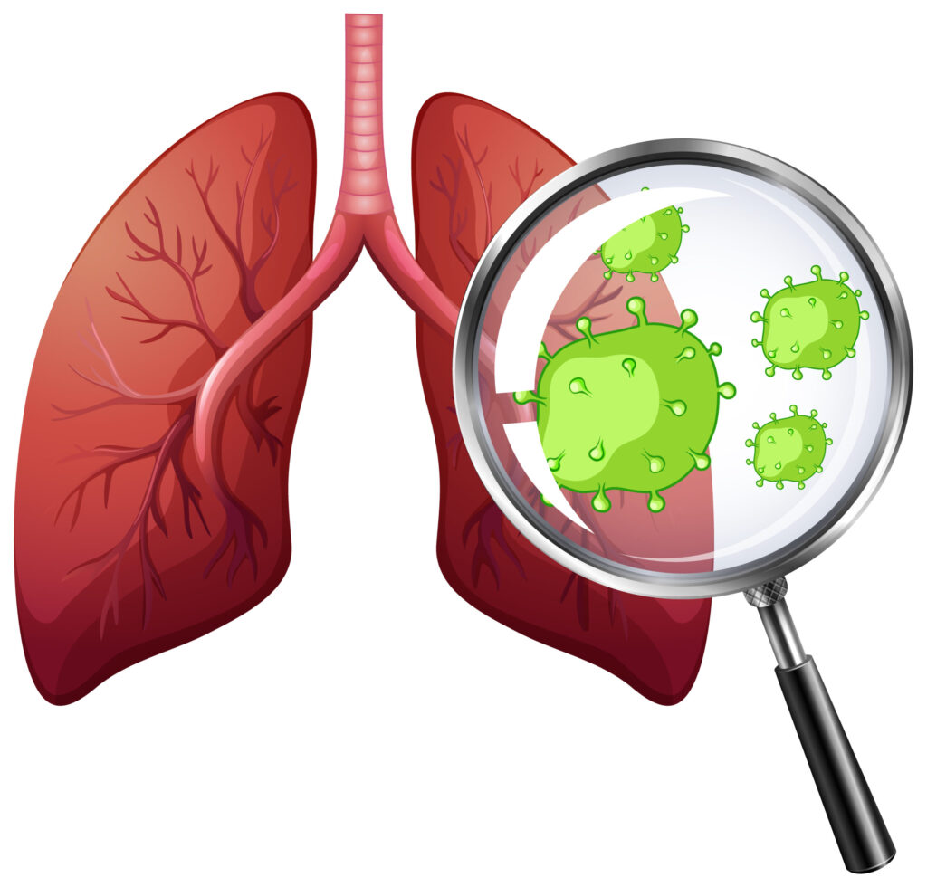 pneumonia doctor kompally scaled.jpg