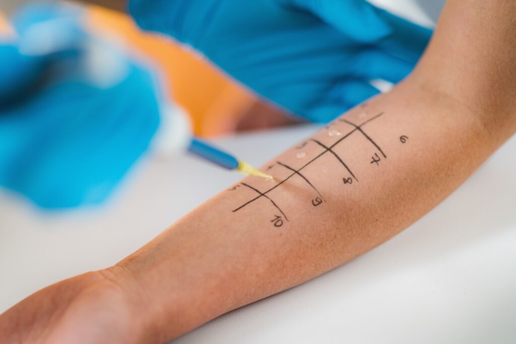 allergy testing 1.jpg